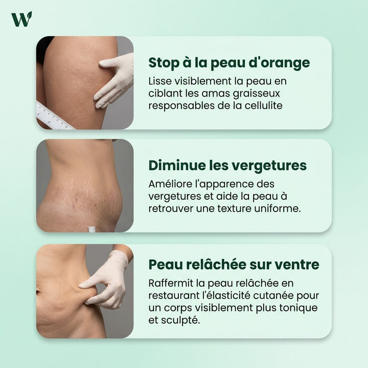 Wendy Anti-Cellulite